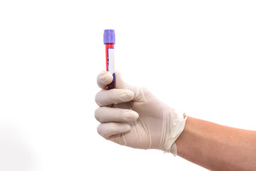 Male hand in protective gloves holding test tube with blood sampler isolated on white