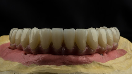 dental implants on a black background