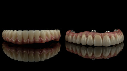 dental implants on a black background
