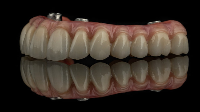 Dental Implants On A Black Background