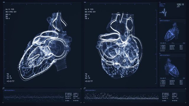 Heart scan screen animation. Ultrasound device. Blood pressure and heart rate displayed on modern and high-tech screen. Health data. Diagnosis of diseases. The future of MRI video. 4K medical footage