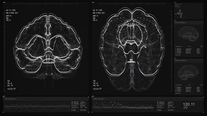 Brain scan visualization footage. The device scans and displays vital signs on the screen. Neurology data analysis process. Diagnosis of disease. Futuristic MRI video. 4K Monochrome Medical animation - Powered by Adobe
