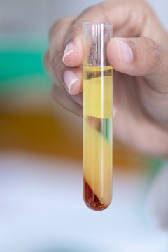Biodiesel production is the process of producing the biofuel, biodiesel, in laboratory.