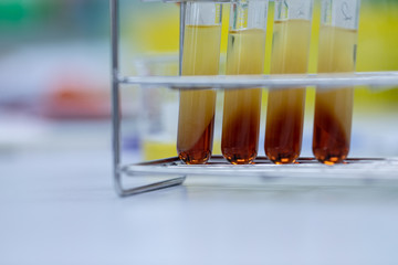 Biodiesel production is the process of producing the biofuel, biodiesel, in laboratory.