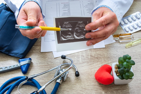 Ultrasound examination in cardiology concept photo. Doctor during consultation held in his hand and show to patient printout picture of ultrasound examination with heart pathology of pericarditis 