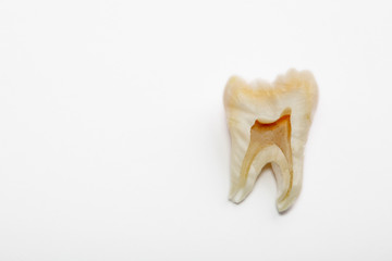  Toothache, human tooth close-up on a red background