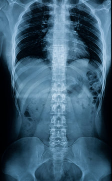 X-ray of a man’s body - spine, pelvic bones, ribs, internal organs