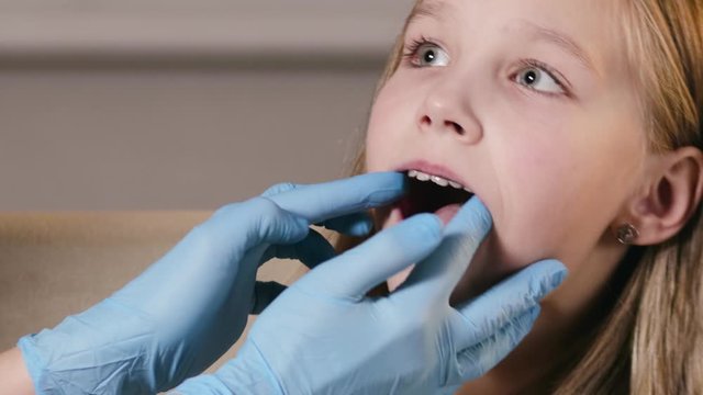 Orthodontist inserts a plate to align the teeth and correct the bite of the child in the clinic. A doctor in blue protective gloves puts a device in a cute girl's mouth