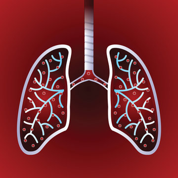 Virus and bacteria infected the Human lungs