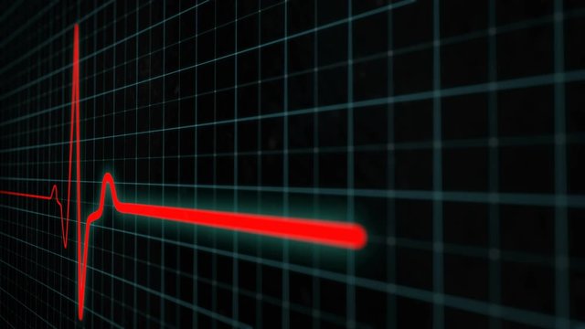 Death of a patient on a cardiologist&rsquo;s monitor. Healthy heartbeat and loose of heartbeat. Pulse trace red line. Red line impulse of heart beating. Electrocardiography. Seamlessly looping footage