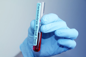 Obraz premium medical laboratory test tube with blood in the hand of a virologist doctor, concept of virology, epidemic, spread of the CoV virus