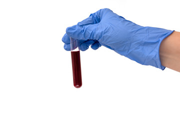 Female hand in medical protective glove holding test tube with blood sample. Coronavirus 2019-nCoV...