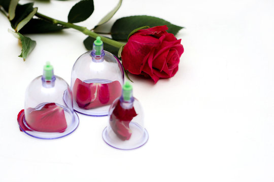 Vacuum therapy Oriental medicine. Hidjama