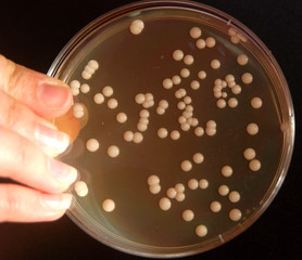 Individual colonies of Saccharomyces cerevisiae growing on solid YPD nutrient medium