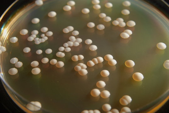 Individual colonies of Saccharomyces cerevisiae growing on solid YPD nutrient medium