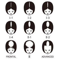 ルードヴィヒの分類 　ハゲ