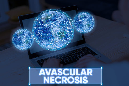 Word writing text Avascular Necrosis. Business photo showcasing death of bone tissue due to a lack of blood supply Elements of this image furnished by NASA