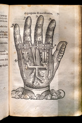 Ambroise Paré (1510 - 1590) French surgeon. page from the book 
