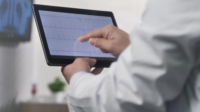 doctor cardiologist from behind looks ecg electrocardiogram record on tablet computer behind a glass