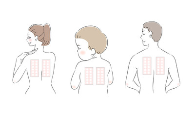 男性　女性　子ども　背中　パッチテスト　スティンギングテスト