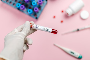 Immunologist holding a blood tube contaminated with coronavirus. Pandemic coronavirus concept