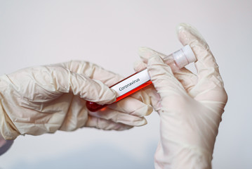 Coronovirus test in medical laboratory