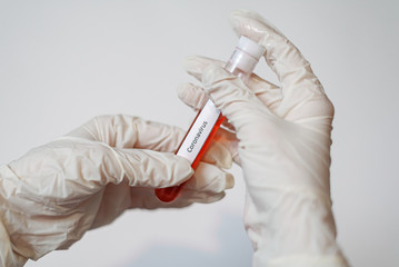 Hand in white gloves with test tube with chinese blood. Coronovirus test research.