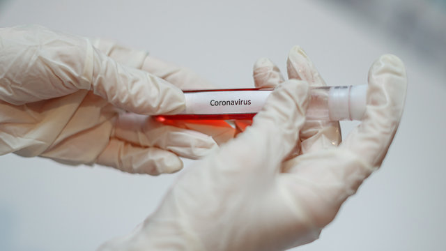 Test tube with blood in medical white gloves. Coronovirus test analysis.