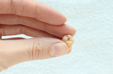 molar tooth about in hands on a white background. Health, Loss, Anatomy