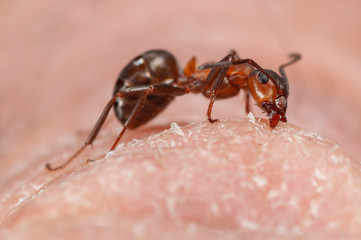 Ameise beißt in Hand