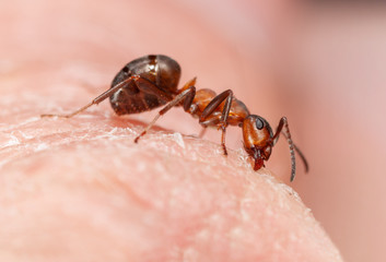 Ameise beißt in Haut