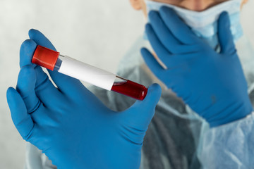 cure for COVID. doctor with blood test in hands. Concept of coronavirus quarantine. Covid-19, originating in Wuhan, China. 2019-nCoV pandemic, Novel Chinese virus, blood analysis. MERS-Cov