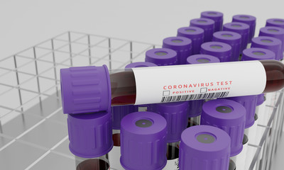 Test tubes with blood and coronavirus test label  isolated on white background. Concept for testing corona virus. 3D Rendering.