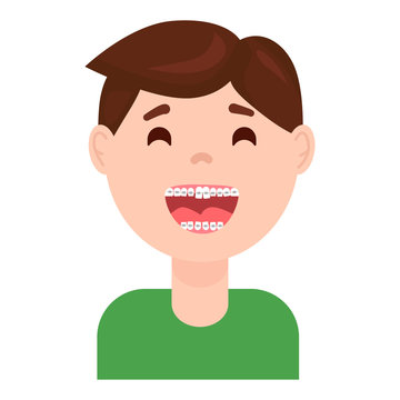 Braces Dental Treatment For Kids. Cute Cartoon Boy With Teeth Braces. Smiling Kids Wearing Braces Vector Illustration.