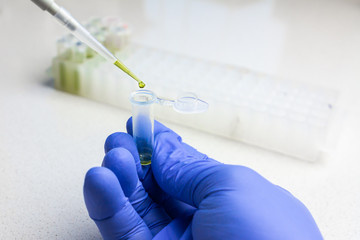 Clinical laboratory in process of chemical analysis. Collection of probe using automatic pipette.