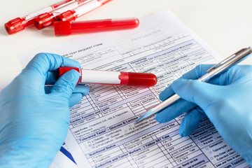 Doctor's hand holding red blood vial with blood sample and filling test form with results.
