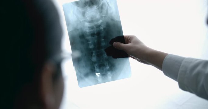 Doctors discussing X-ray scan of spine, developing treatment strategy