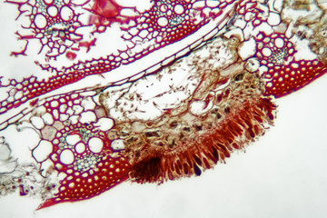 Parasitic plant fungus Puccinia showing teliaspores on a microscope slide.