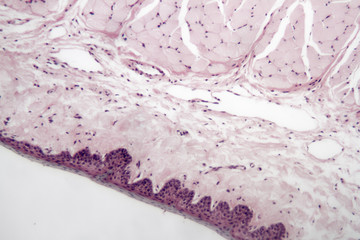 Muscle composite cells on a microscope slide.