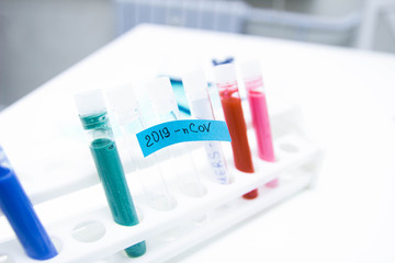 epidemic test and analysis coronavirus, a vaccine and a cure for the virus appeared in Wuhan, China