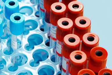 Blood sample tubes  medical equipment close up