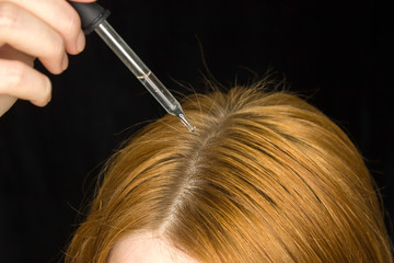 A glass pipette with a hair growth agent is applied to the parting of the hair, red hair. Hair care.