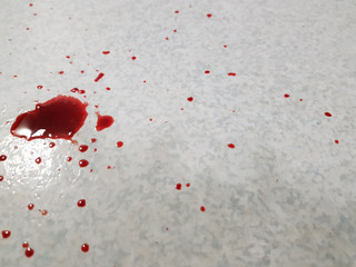 Drops of blood on the floor
