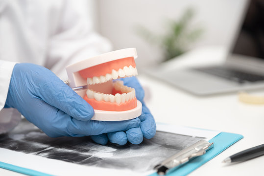 Dentist Consultation How To Care For Healthy Teeth