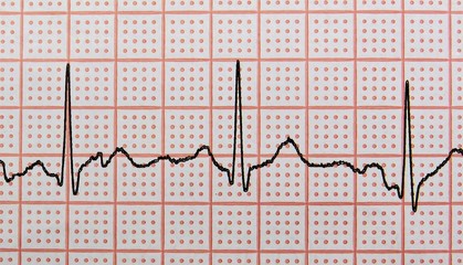 cardiogram EKG with the heartbeat