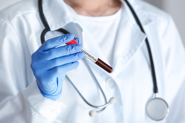 Female doctor holding blood sample in test tube with text CORONAVIRUS, closeup