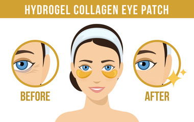 Obraz premium Before and after hydrogel eye patches. Cosmetic collagen eye patches. Golden eye patches for beauty and skin care. Vector