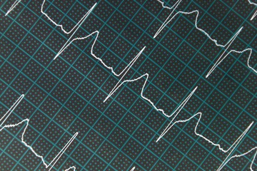 an EKG electrocardiogram with heart pulse