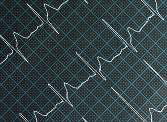 cardiogram EKG with the heartbeat