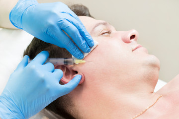 The man underwent a course of mesotherapy in the clinic to improve the condition of the skin of the face.